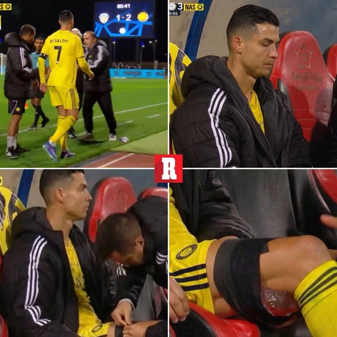 leyucom官网登录入口地址-美媒：C罗可能是腿筋受伤，若情况属实或影响他参加3月国家队比赛